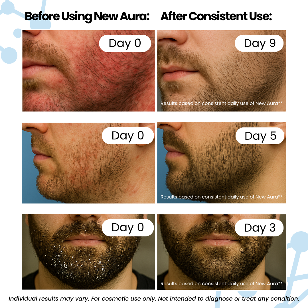 New Aura™ Anti-Fungal Beard Cream